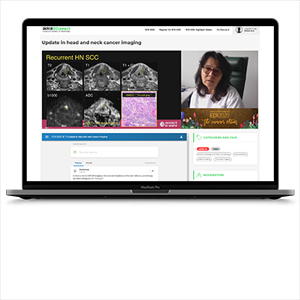 meta-fusion_2020-07-16 14_30_19-Update in head and neck cancer imaging - ESR Connect Kopie